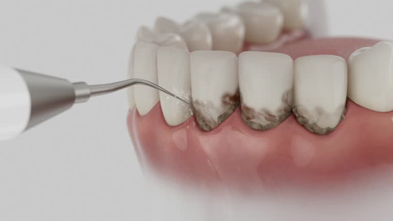 Trusted Tooth Extraction service in Kirby, TX - Dentist Open Now